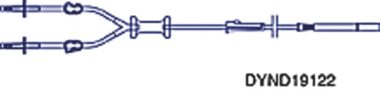 Medline Cysto/TUR Irrigation Sets with Cylindrical Drip Chamber and Clamp, with Y-Type Clamp, 0.188" x 90" (4.8 mm x 229 cm)