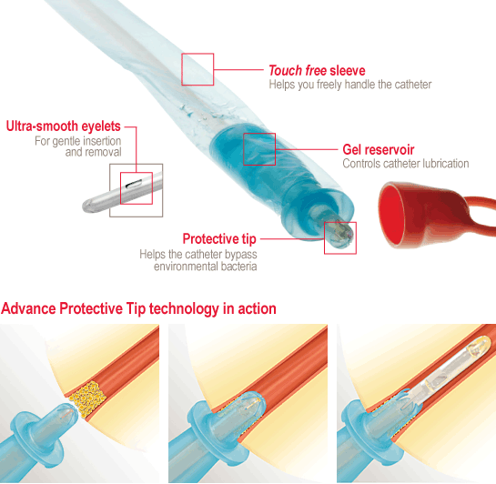 Touch Free Advance Ic Intermittent Coude Catheter W/ Intro Tip, Size 16fr 16in